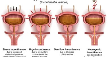 Is it Hard to Become a Holistic Health Coach? 4 Tips for Living Well With Incontinence