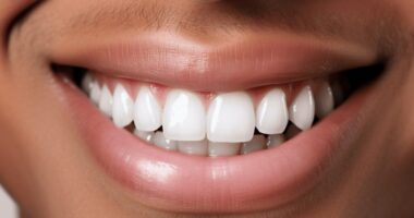 How to Tell If Your Gum Inflammation Needs Medical Attention Preventing Tooth Decay – Essential Tips for a Healthy Smile